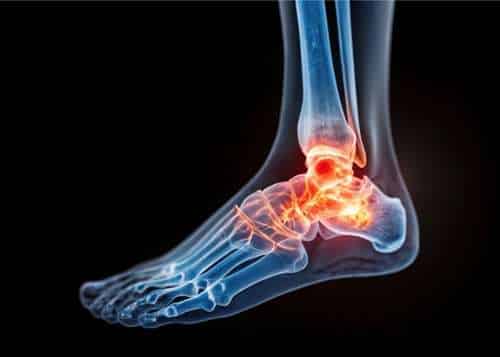 visual representation of internal foot anatomy